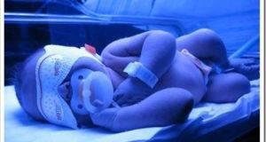 Фототерапевтические лампы для новорожденных: показания и противопоказания