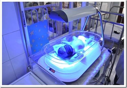 Фототерапевтические лампы для новорожденных