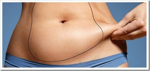 Сложность избавления от жировых отложений у женщин 