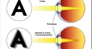 Как понять, что присутствуют проблемы со зрением?