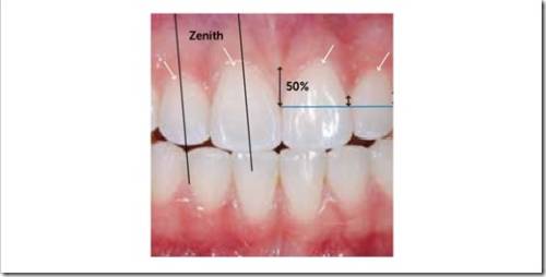 Положение зубов и форма зубной дуги в эстетической стоматологии